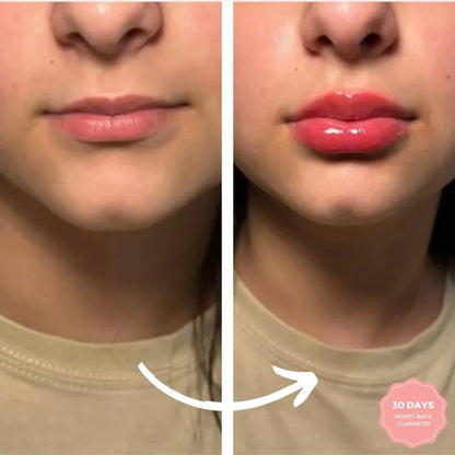 GlowLips™ - LipLift Set