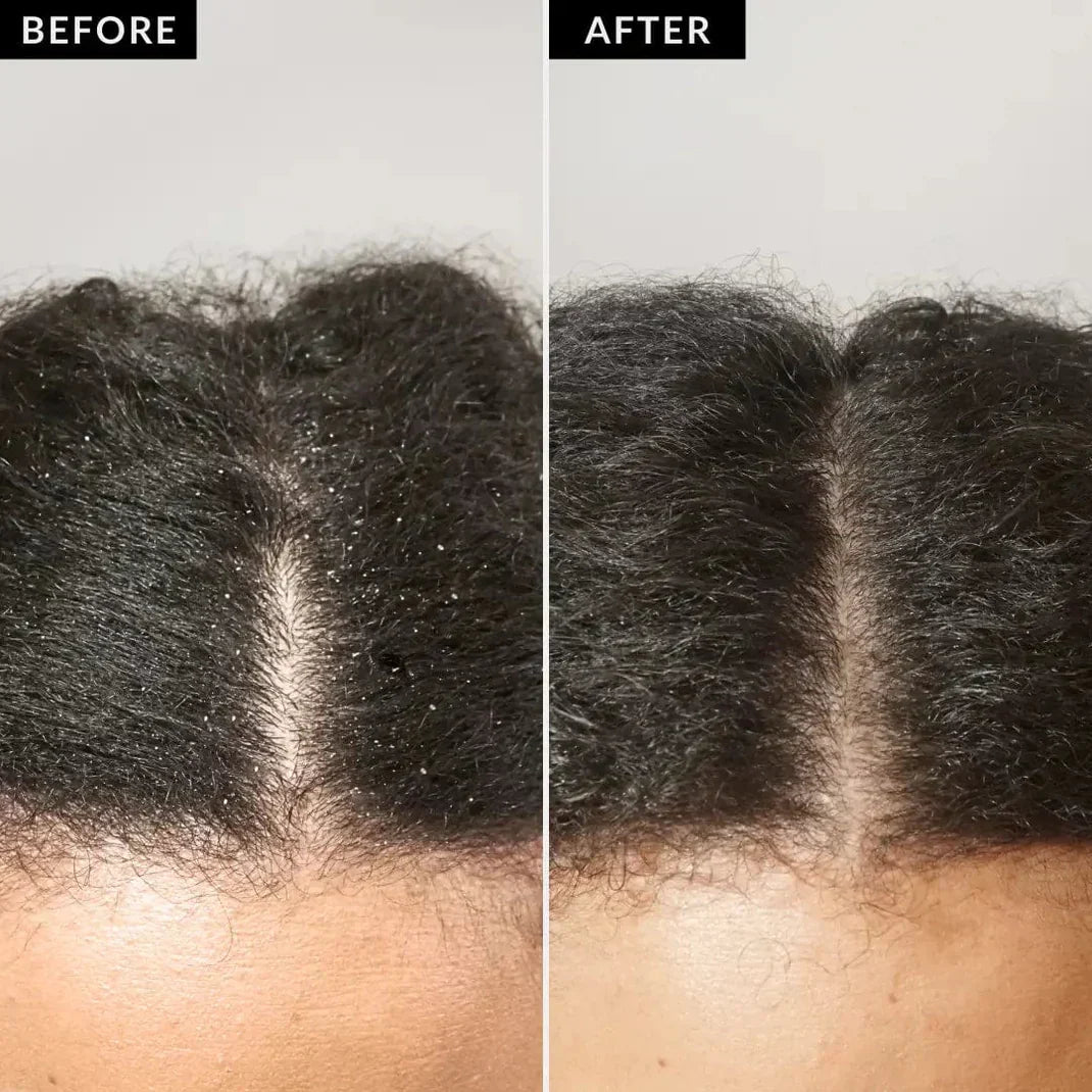 HealthyRoots™ - Scalp Detox Comb